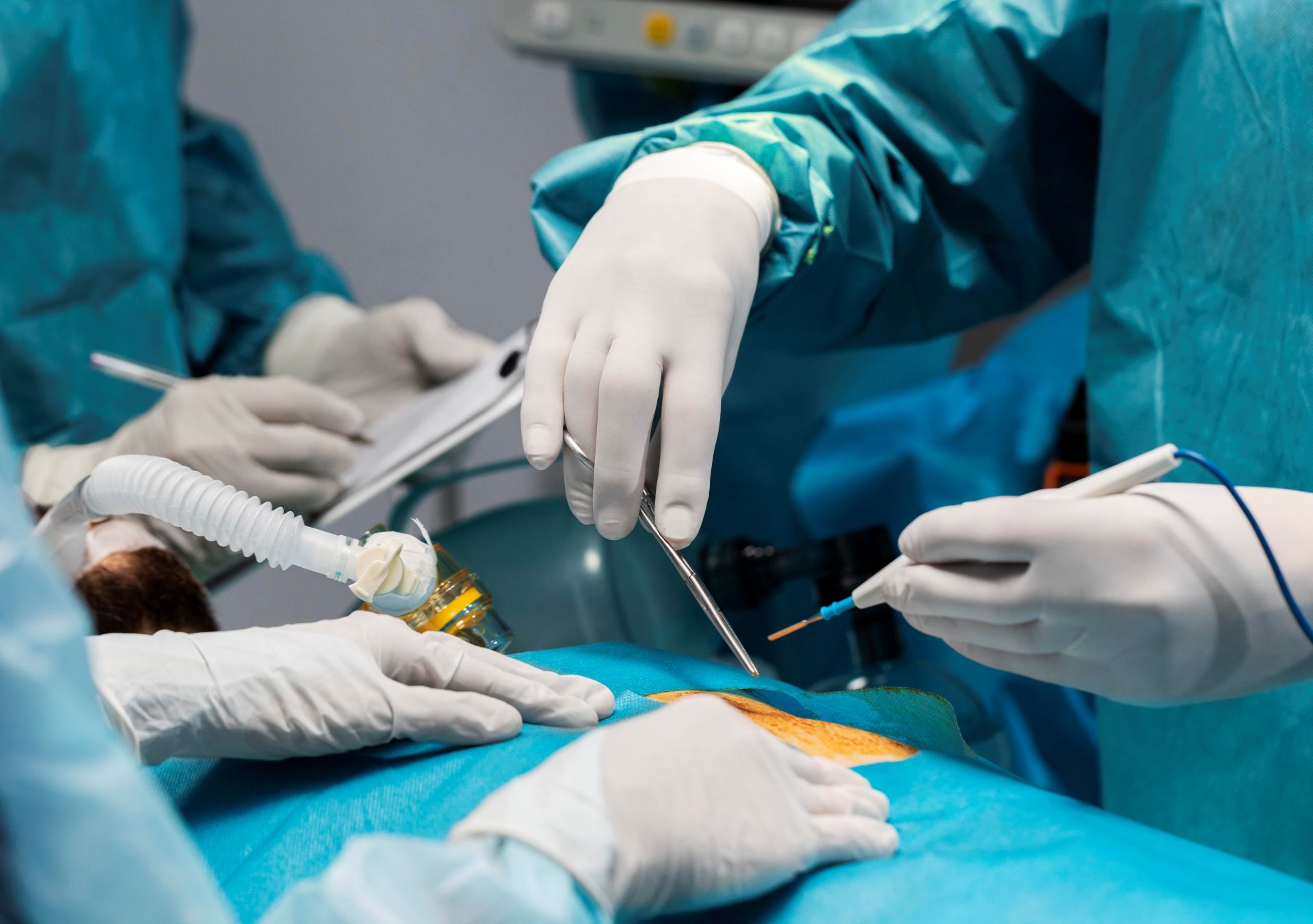 Chirurgie de l’aorte ascendante